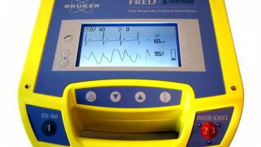 Defibrillator, Monitoring